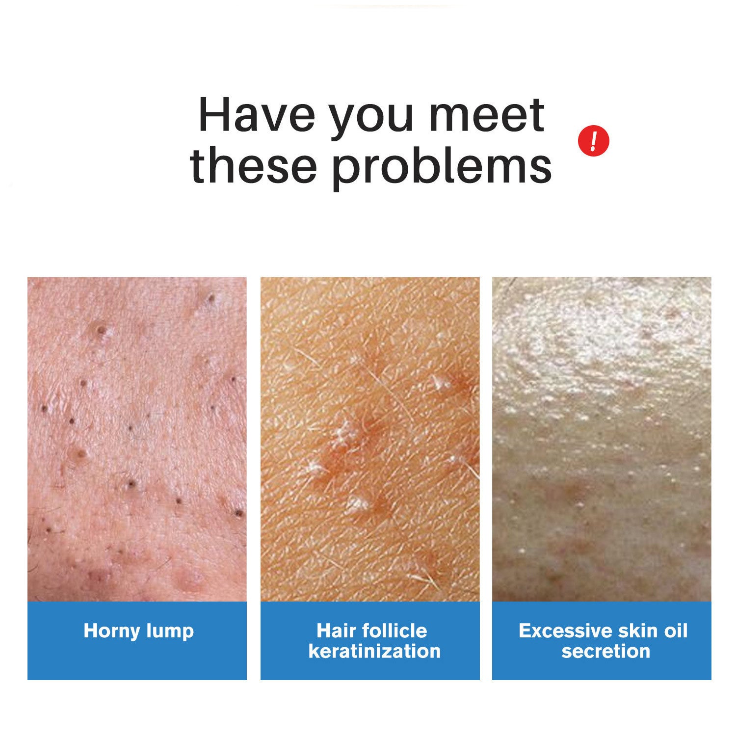 Cross-border new product lanthome facial scrub soap essential oil cleansing facial body scrub soap 100g